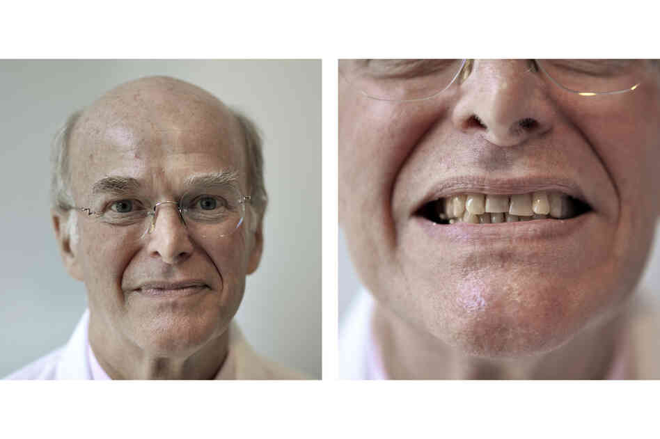 Orthodontist Robert Williams never had braces, and has no plans to improve his teeth. Invisalign, a clear orthodontic device, might straighten his front teeth, he says, but it's not worth the problems it would cause for his back teeth.