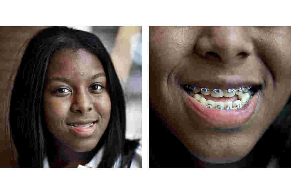 Quinique Jones, 15, will soon be free of braces. Her mother, Pamika Lee, says they have perfected her smile.