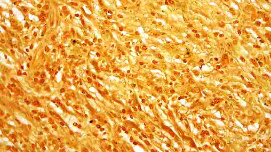 Treponema pallidum, the bacteria that cause syphilis.