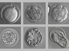 Human embryos developing in vitro. Human embryos developing in vitro.