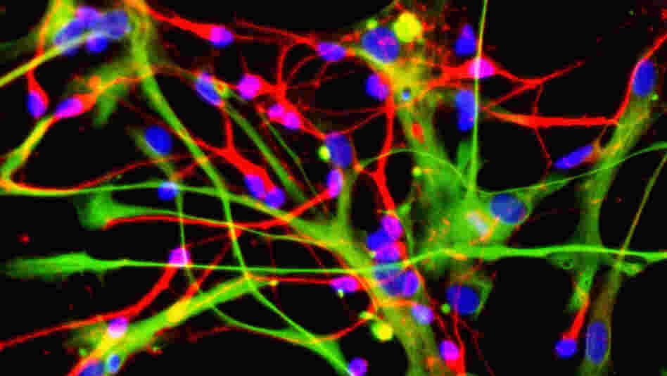 Neurons and astrocytes, made from neural stem cells Neurons and astrocytes, made from neural stem cells