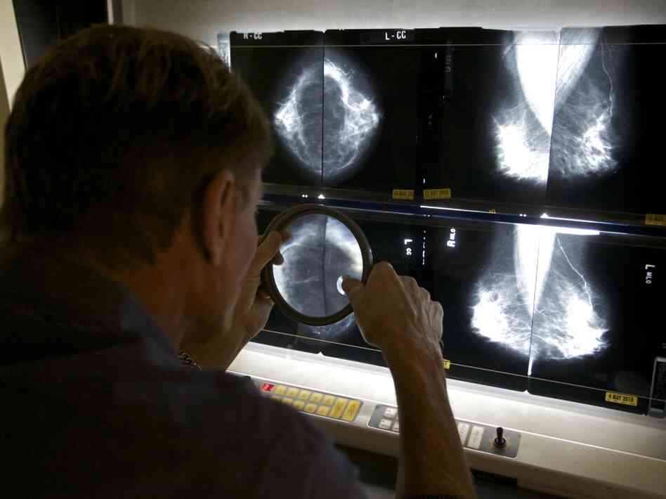 Mammograms Mammograms