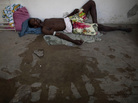 man suffering from cholera man suffering from cholera