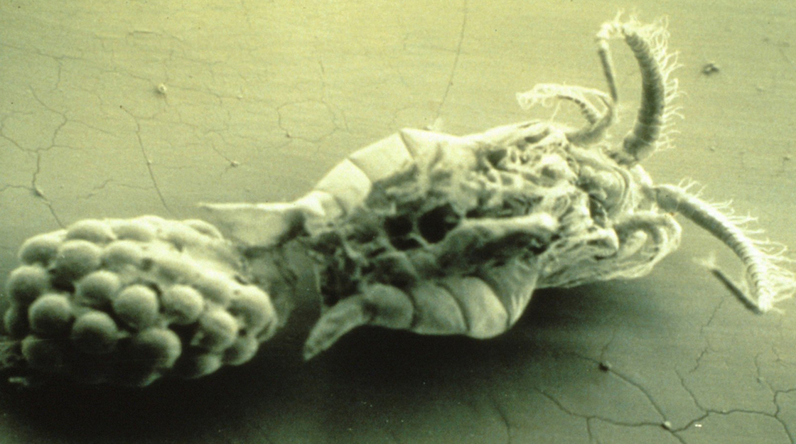 A closeup of Eurytemora, the copepod that serves as reservoir for the cholera bacterium. 