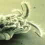 A closeup of Eurytemora, the copepod that serves as reservoir for the cholera bacterium. A closeup of Eurytemora, the copepod that serves as reservoir for the cholera bacterium.