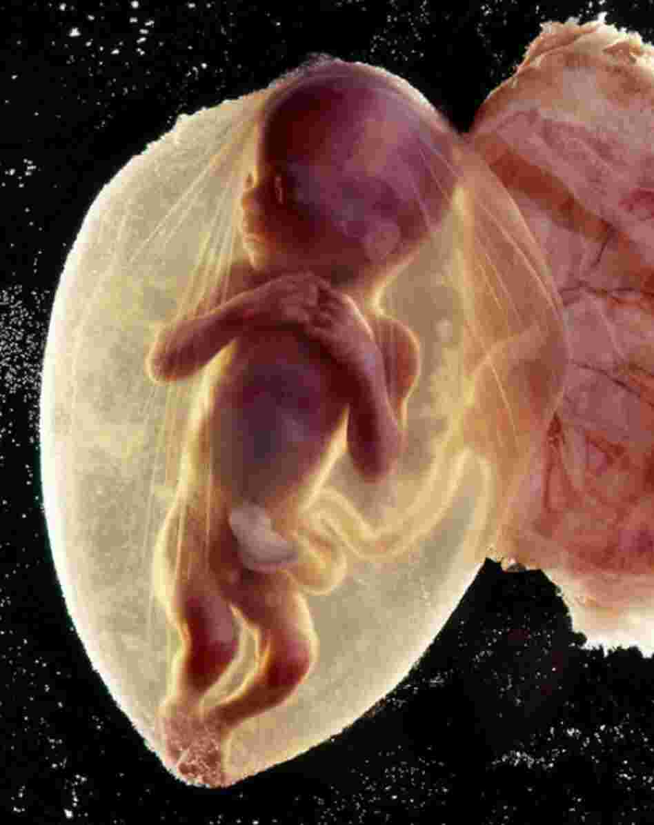 What could be more important than life itself? Lennart Nilsson is as much a scientist as he is a photographer. His 1965 story about the "Drama of Life Before Birth" was a decade in the making, and was like nothing we had seen. The pictures of a well-formed fetus floating as if in space sparked a fresh debate about when life begins. When I directly asked Lennart the question, he demurred:  "Perh...