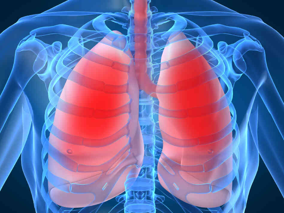 Lung infections are a common killer Lung infections are a common killer
