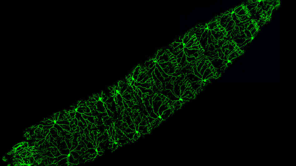 A fruit fly larva's photosensing neurons A fruit fly larva's photosensing neurons