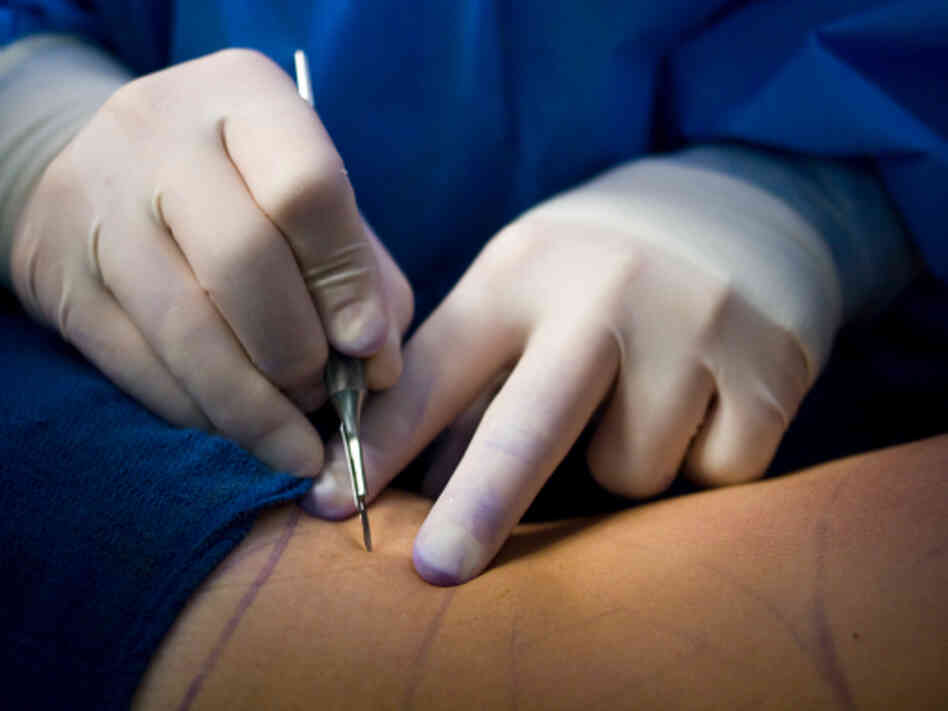 Surgeon with scalpal Surgeon with scalpal