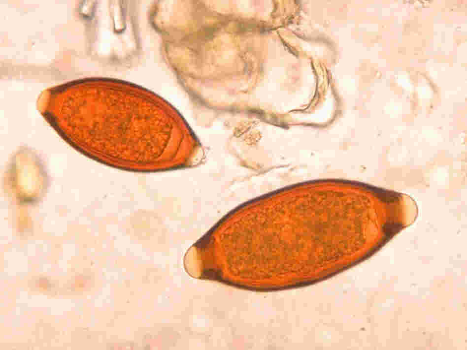Eggs of the parasite Trichuris trichiur