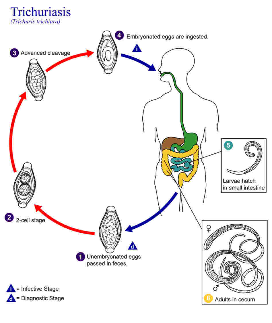 An illustration of the life cycle of Trichuris trichiura