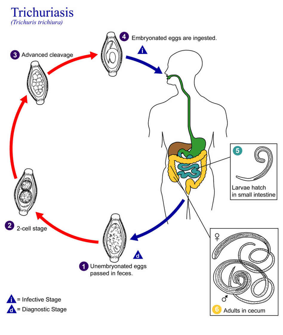 An illustration of the life cycle of Trichuris trichiura