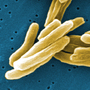Tuberculosis bacteria appear gold against a blue background. Tuberculosis bacteria appear gold against a blue background.