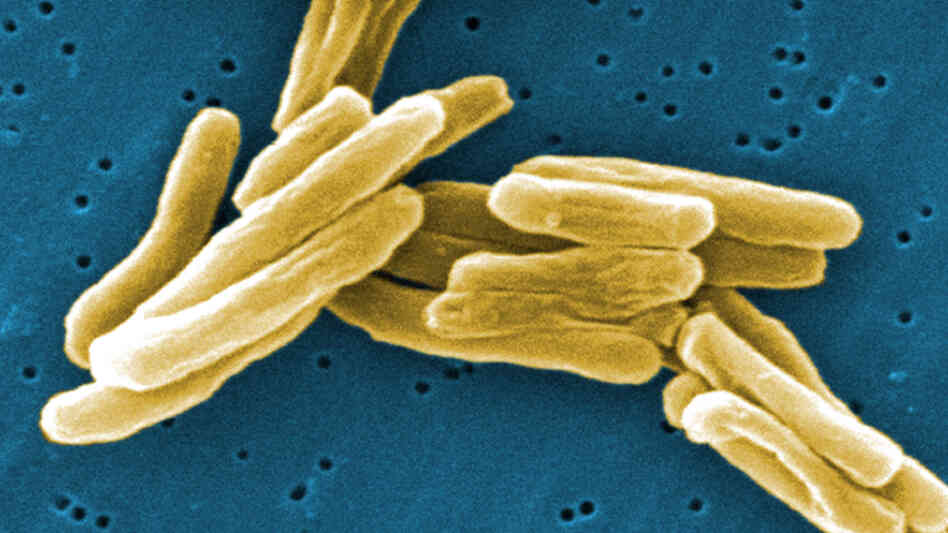 Tuberculosis bacteria appear gold against a blue background. Tuberculosis bacteria appear gold against a blue background.