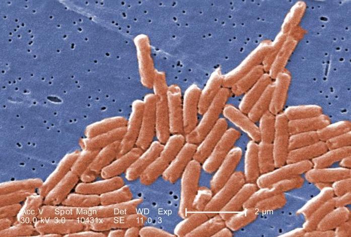 Salmonella like these are a leading cause of foodborne illnesses, hospitalizations and deaths.
