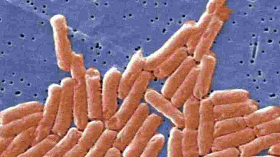 Salmonella like these are a leading cause of foodborne illnesses, hospitalizations and deaths.