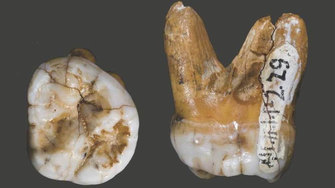 This tooth, which was also found in Denisova Cave, has a DNA structure similar to that of a finger bone, but a shape and physical structure very different from that of Neanderthals and modern humans. This leads researchers to believe that the Denisova are an evolutionarily distinct group.