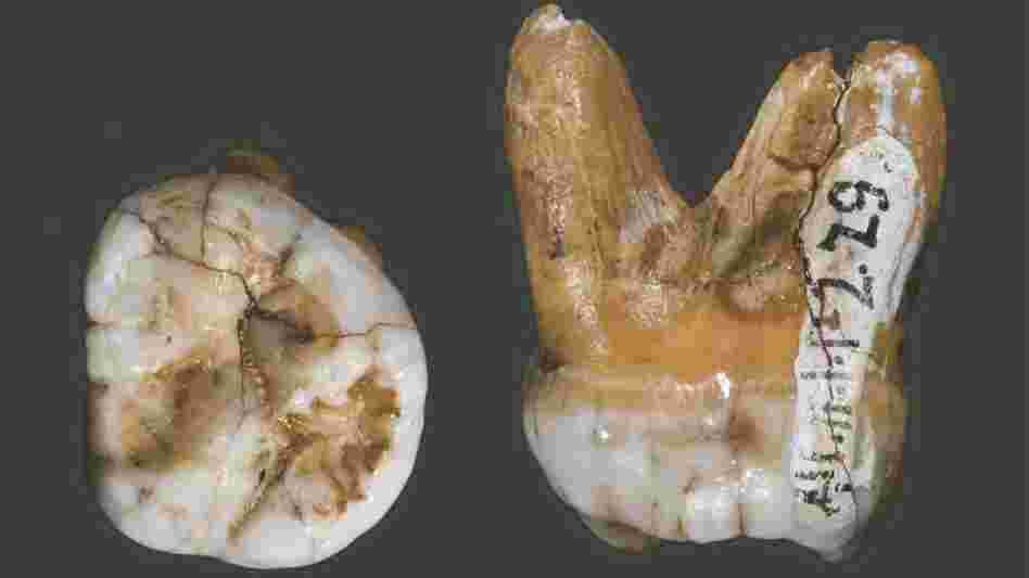 This tooth, which was also found in Denisova Cave, has a DNA structure similar to that of a finger bone, but a shape and physical structure very different from that of Neanderthals and modern humans. This leads researchers to believe that the Denisova are an evolutionarily distinct group.