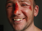 Adam Potter, from Glasgow, after his fall. Adam Potter, from Glasgow, after his fall.