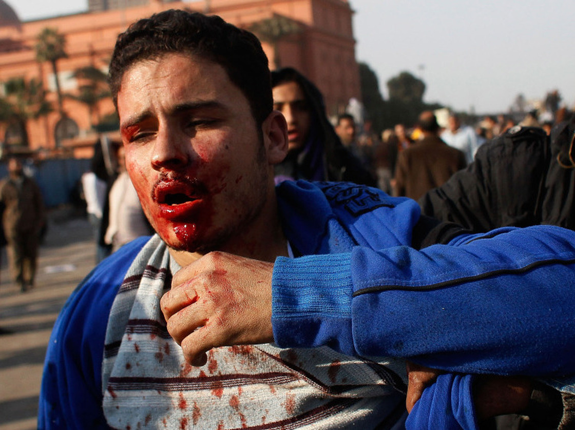 A wounded man in Tahir Square today (Feb. 2, 2011).