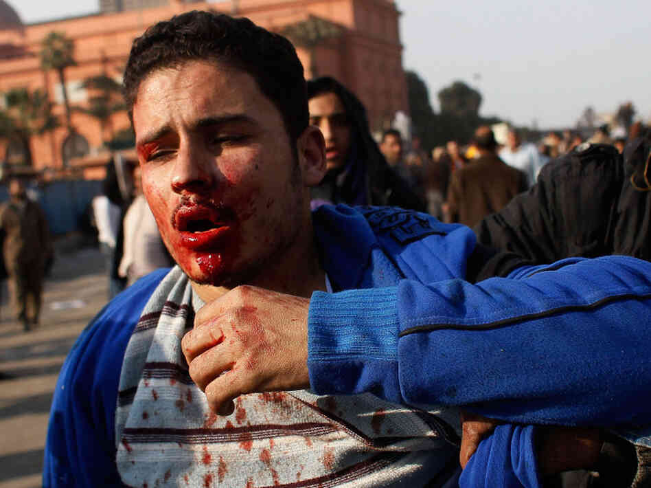 A wounded man in Tahir Square today (Feb. 2, 2011).