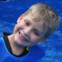 Brett Hallman had a surgery — as a 25-week fetus — to treat his spina bifida. Now, he's an active first grader who enjoys swimming and other sports. Brett Hallman had a surgery — as a 25-week fetus — to treat his spina bifida. Now, he's an active first grader who enjoys swimming and other sports.