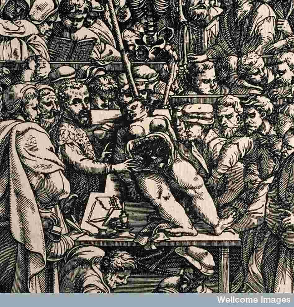A dissector-entertainer dissects a female cadaver in front of a large crowd, c. 1555 A dissector-entertainer dissects a female cadaver in front of a large crowd, c. 1555