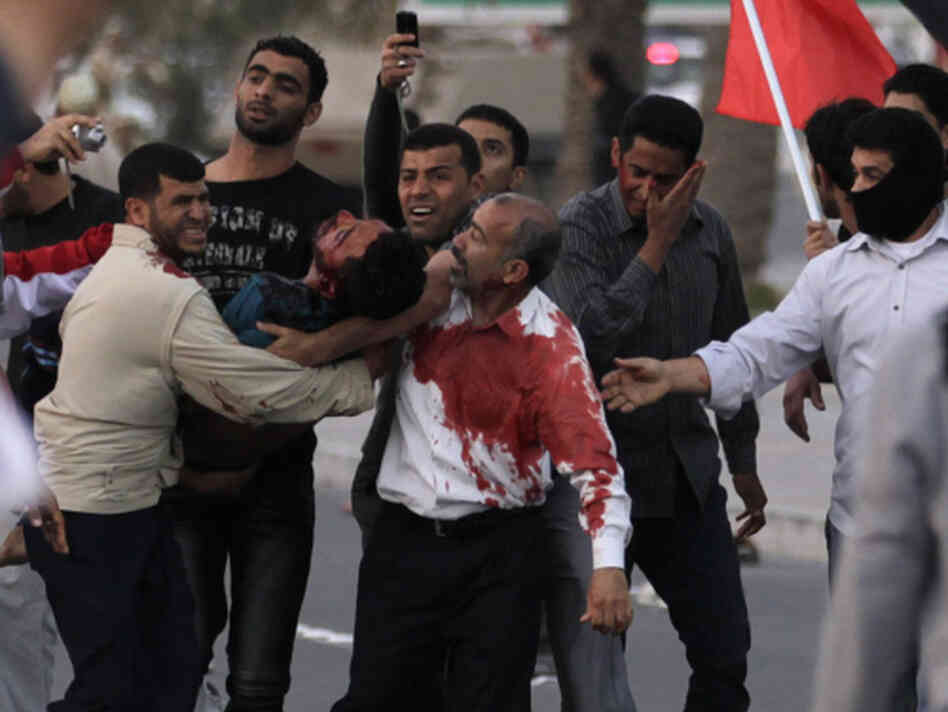 An unidentified man is carried to a vehicle to be taken to a hospital after being wounded during a demonstration in Manama, Bahrain, today (Feb. 18, 2011). An unidentified man is carried to a vehicle to be taken to a hospital after being wounded during a demonstration in Manama, Bahrain, today (Feb. 18, 2011).