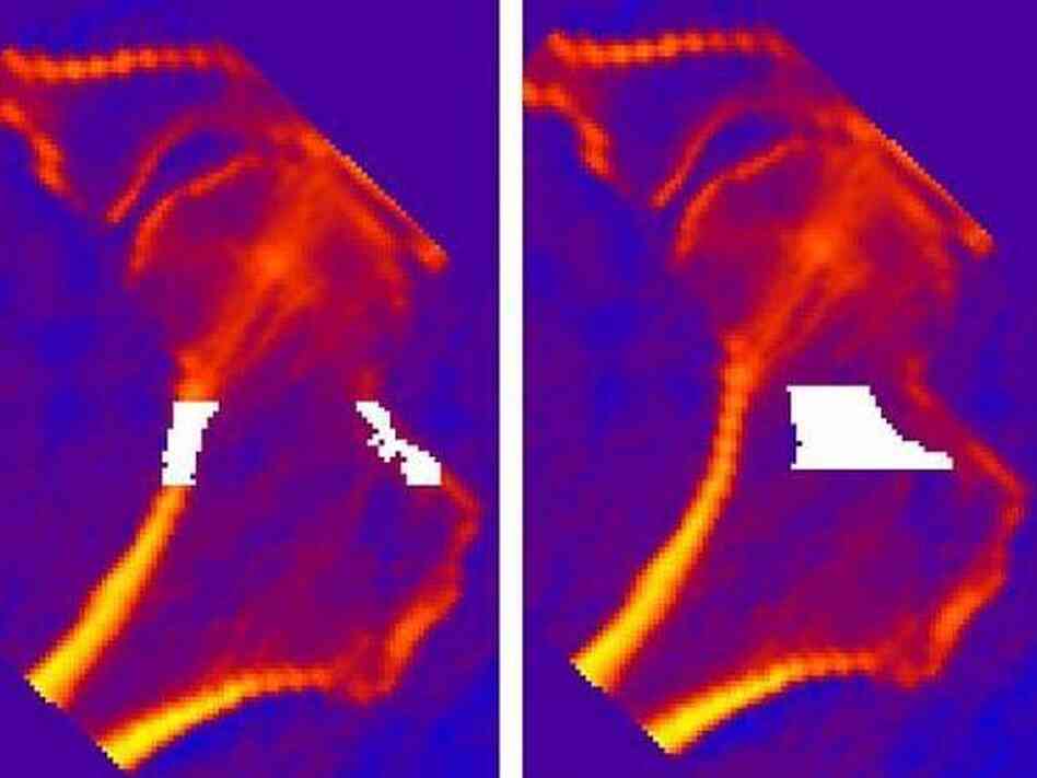 NASA scientists are also studying how bisphosphonates affect the density of hip bones, pictured here.