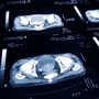 An enlarged cancerous prostate is shown on a tomography scan. An enlarged cancerous prostate is shown on a tomography scan.