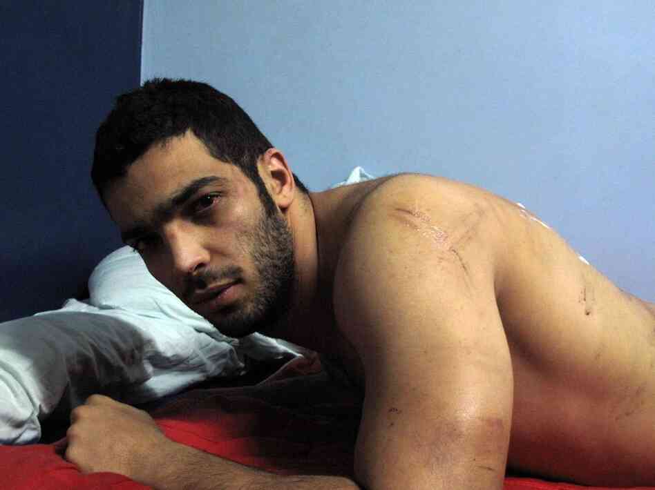 Musician Ramy Essam, 23, says he was tortured while under the custody of the Egyptian military after being rounded up with several other protesters in Tahrir Square on March 9.