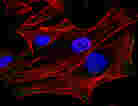 HeLa Cells HeLa Cells