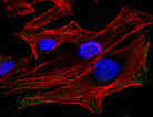 HeLa Cells HeLa Cells