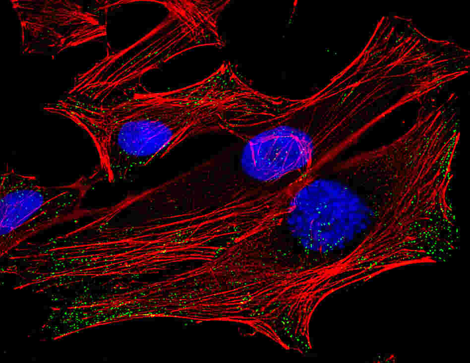 HeLa Cells