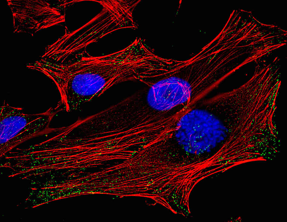 HeLa Cells