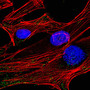 HeLa Cells