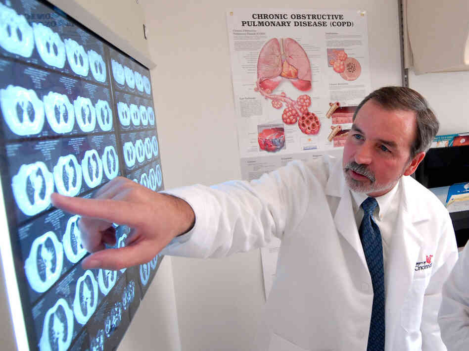 Frank McCormack, a physician who studies LAM, says that expert patients like the members of the LAM Facebook group actually make a doctor's job easier.