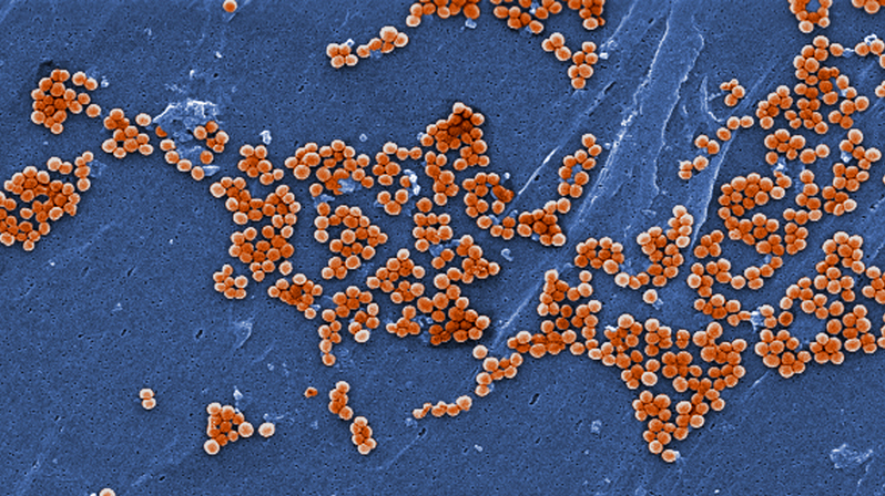 Meet the enemy: methicillin-resistant Staphylococcus aureus bacteria, commonly referred to as MRSA.