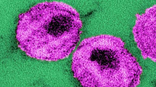 HIV viral particles as seen under an electron microscope.