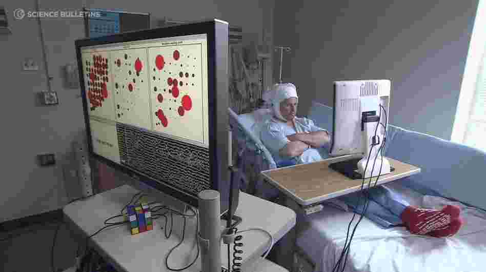 A patient participates in a brain-computer interface study. By placing an array of sensors directly on the brain and connecting them to a computer, researchers are able to decode brain signals into meaningful information, including some words. A patient participates in a brain-computer interface study. By placing an array of sensors directly on the brain and connecting them to a computer, researchers are able to decode brain signals into meaningful information, including some words.
