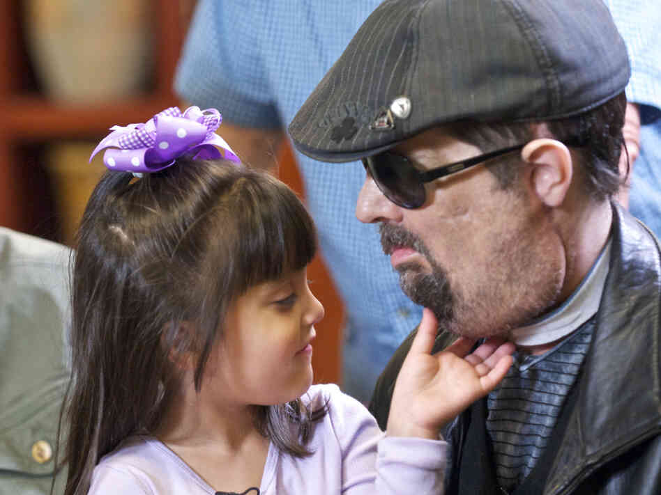 Scarlette Wiens touches the chin of her father, face-transplant recipient Dallas Wiens.