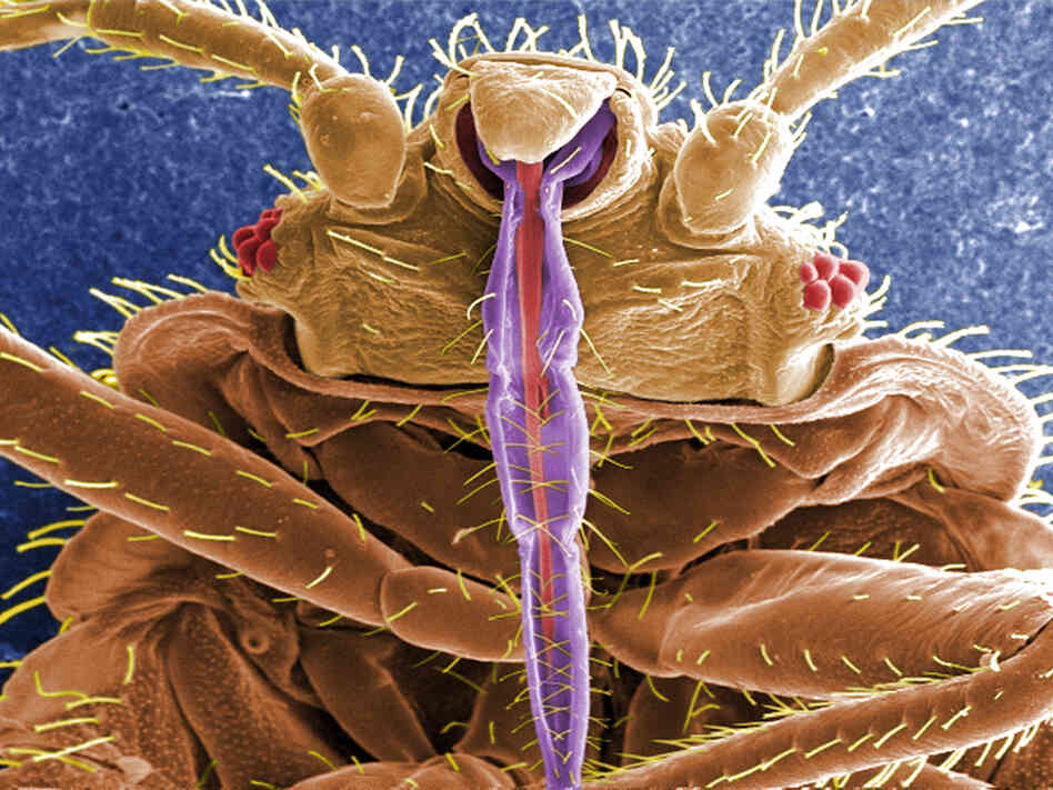 A bedbug, up close, shows off its skin-piercing mouth parts in purple.