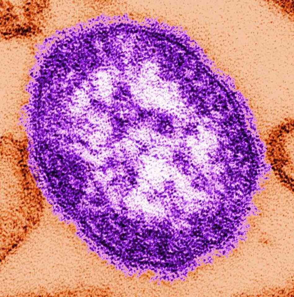 A look inside a single measles virus particle, or virion, made with an electron microscope.