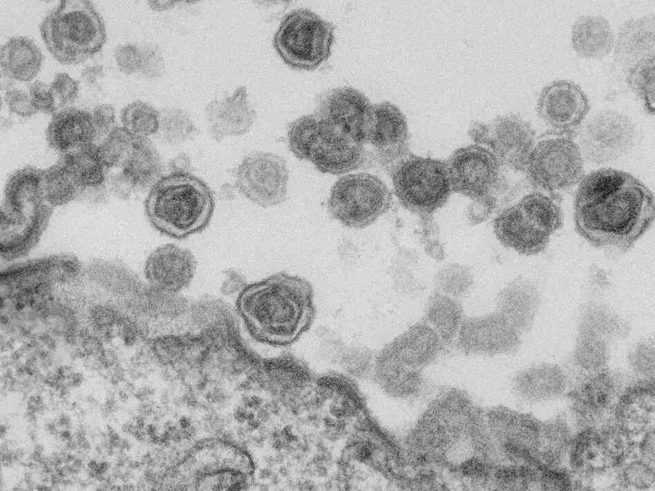 XMRV, a mouse virus, may be an artifact of laboratory experiments rather than the cause of chronic fatigue syndrome. XMRV, a mouse virus, may be an artifact of laboratory experiments rather than the cause of chronic fatigue syndrome.