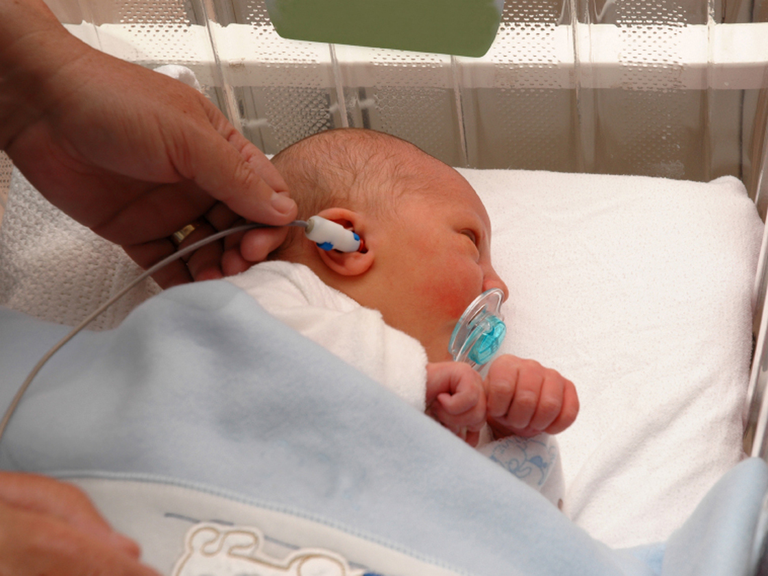 A newborn gets a hearing test. Cytomegalovirus is a major cause of hearing loss in babies.
