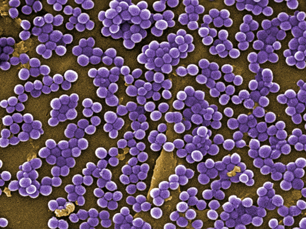 A colorized scanning electron micrograph showing clumps of methicillin-resistant Staphylococcus aureus bacteria in 2005.