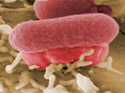 A closeup view of the bacterium behind the foodborne disease outbreak centered in Germany. A closeup view of the bacterium behind the foodborne disease outbreak centered in Germany.
