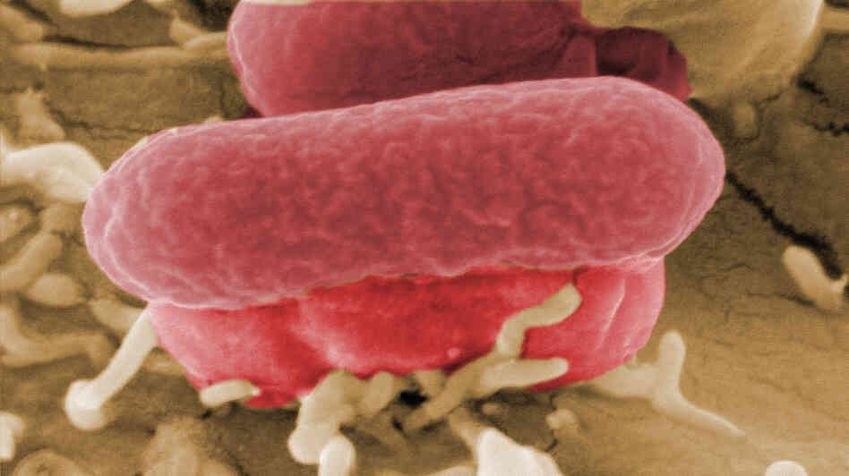 A closeup view of the bacterium behind the foodborne disease outbreak centered in Germany.