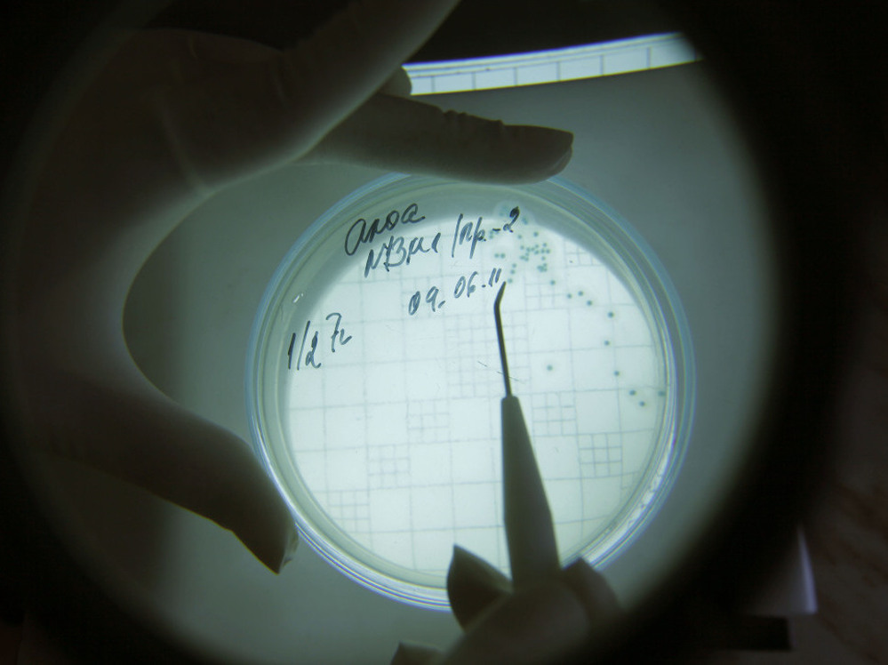 A laboratory technician counts isolated Escherichia coli bacteria.