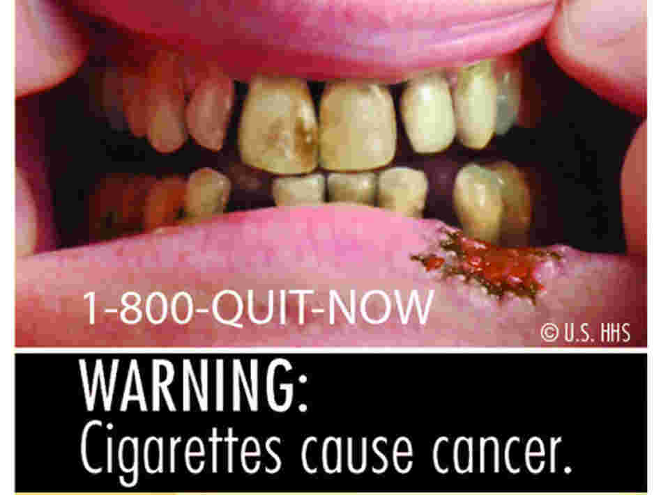 One of the nine new warning labels that will be featured on cigarette packs next year. One of the nine new warning labels that will be featured on cigarette packs next year.